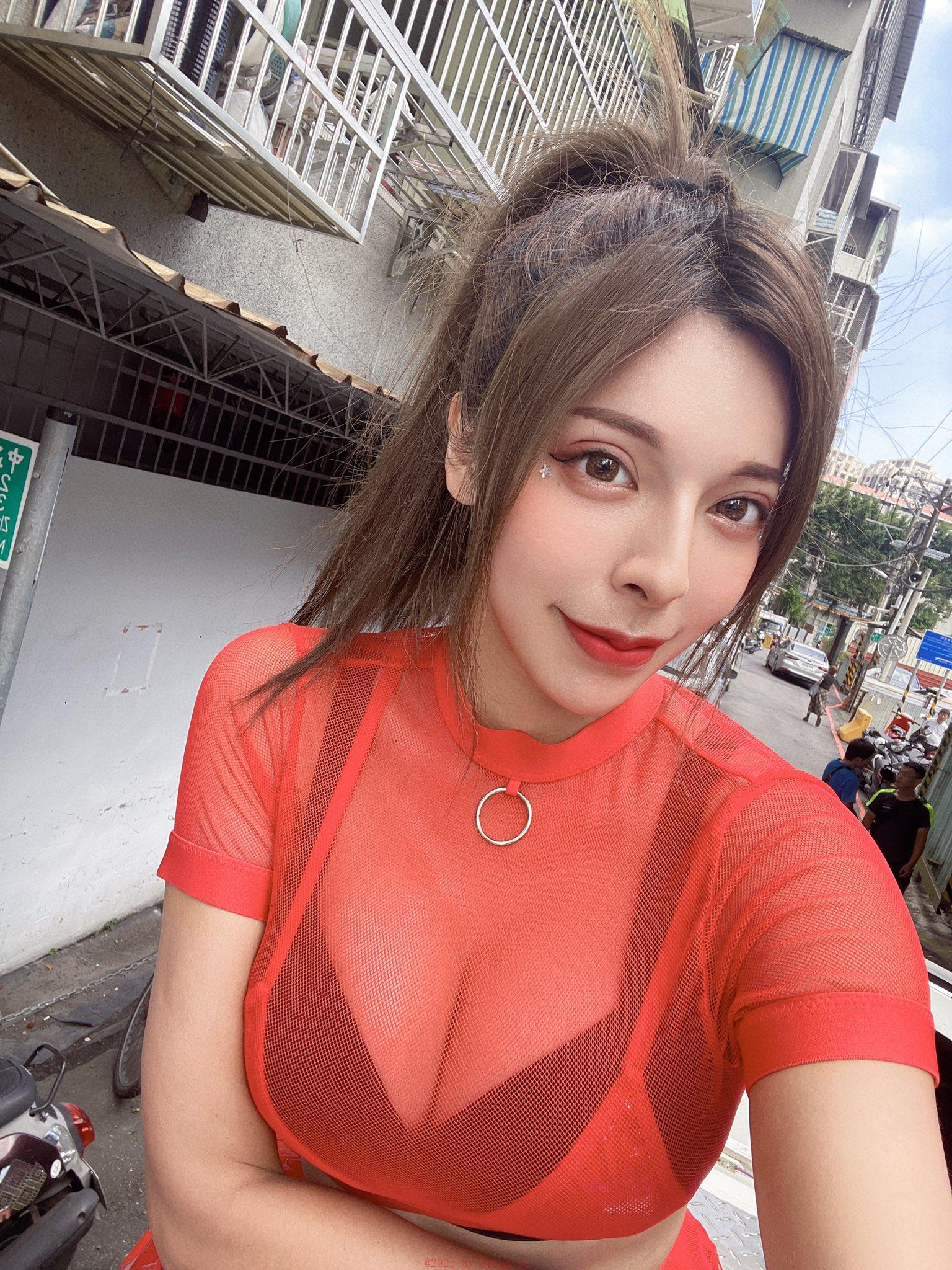 阴道松弛 做阴道紧缩术需注意哪些事项